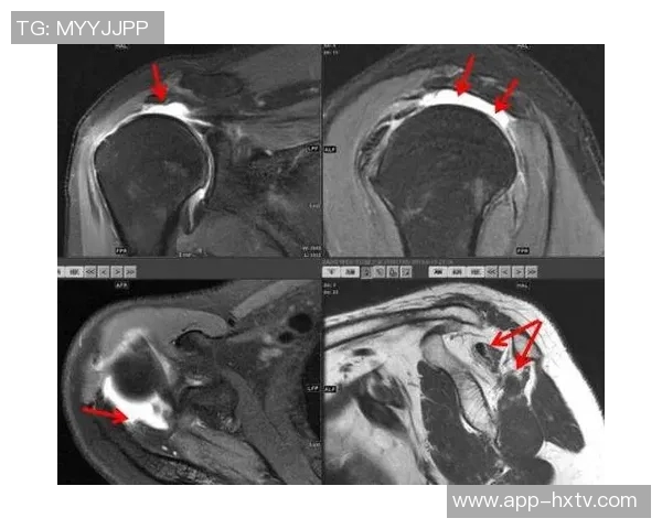 约维奇重摔受伤退场X光检查结果无异常明日将进行MRI检查评估伤情